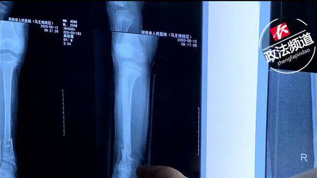 挺进她的花苞～啊太深了视频 相关产品