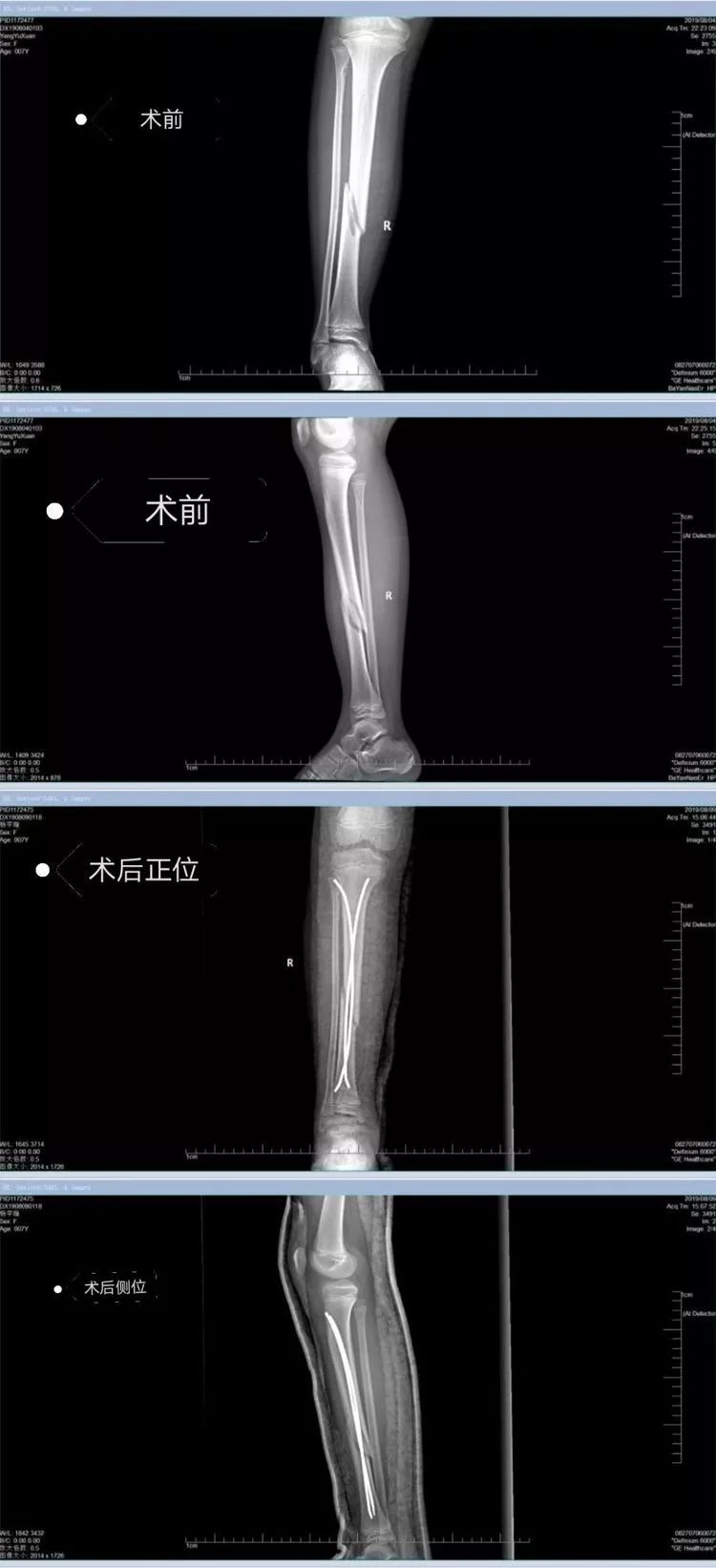 没有马赛克的打卜克 相关产品