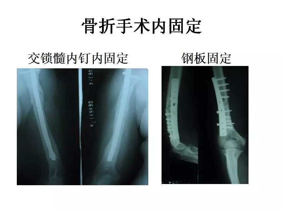 琪琪云播 相关产品