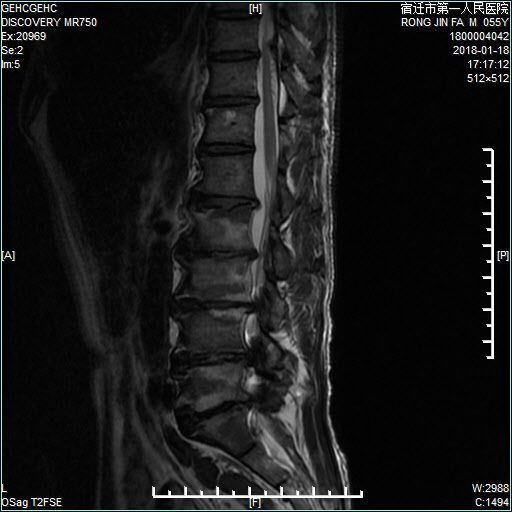 一支笔怎么自wei 匿名性可能降低自我监控 产品主图