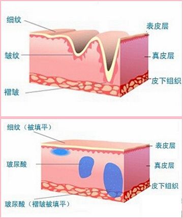 JEALOUSVUE成熟50MA欢迎光临 在严格内容审核的匿名平台中