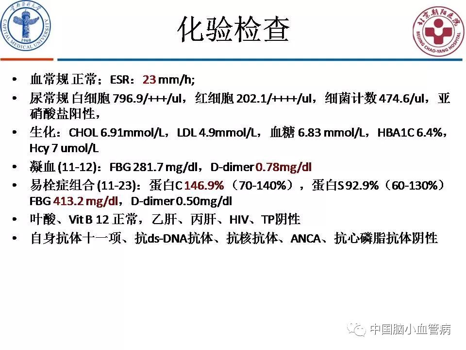 无限臀17c 相关产品